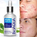 Suero pure Skine Bioaqua